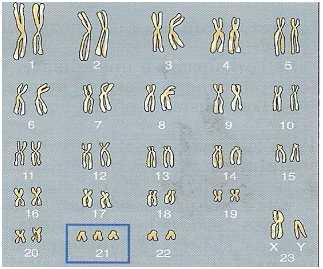 DNA25.jpg (14644 byte)